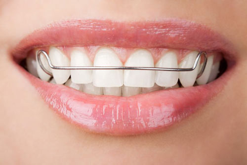 orthodontist ballarat