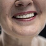 white spots on teeth